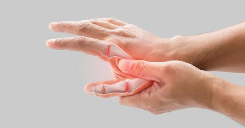 İltihaplı Romatizma Belirtileri Nelerdir? İltihaplı Romatizma Nasıl Anlaşılır? Tedavi Yöntemleri Nelerdir?