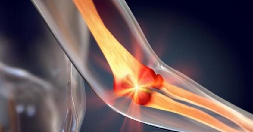 Kalsiyumunuz eksikse bu hastalıklara yakalanabilirsiniz! Kalsiyum Eksikliğinde Görülen Hastalıklar Nelerdir? Kalsiyum Eksikliği Hangi Hastalıklara Neden Olur?